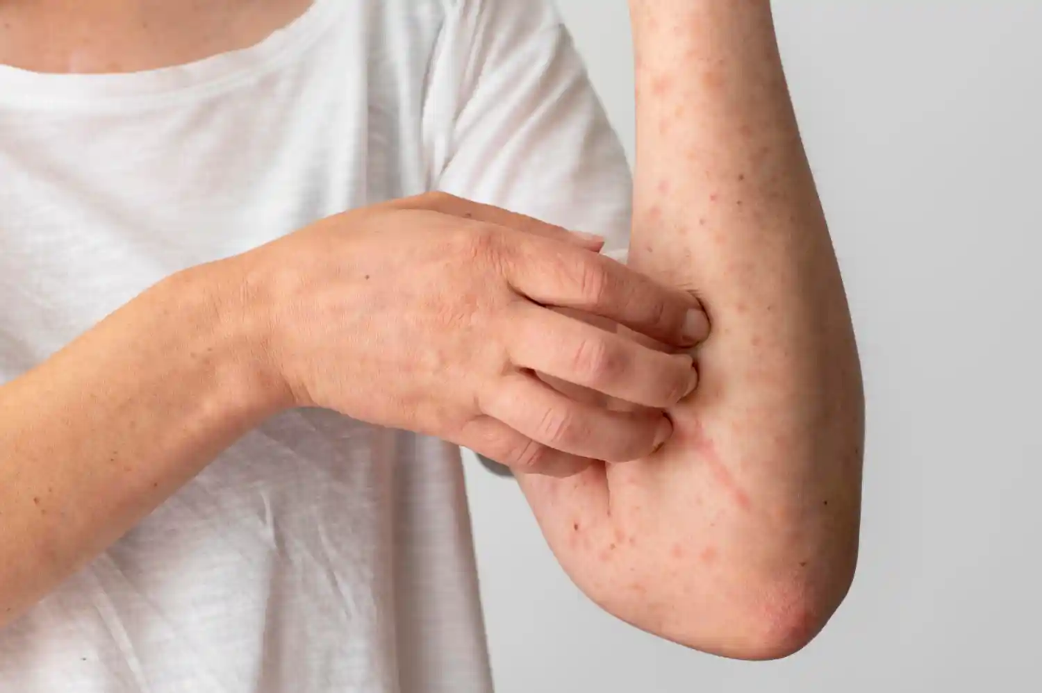 Comment Se Débarrasser des Puces ?